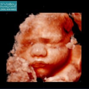 Meet your Posher, Alma